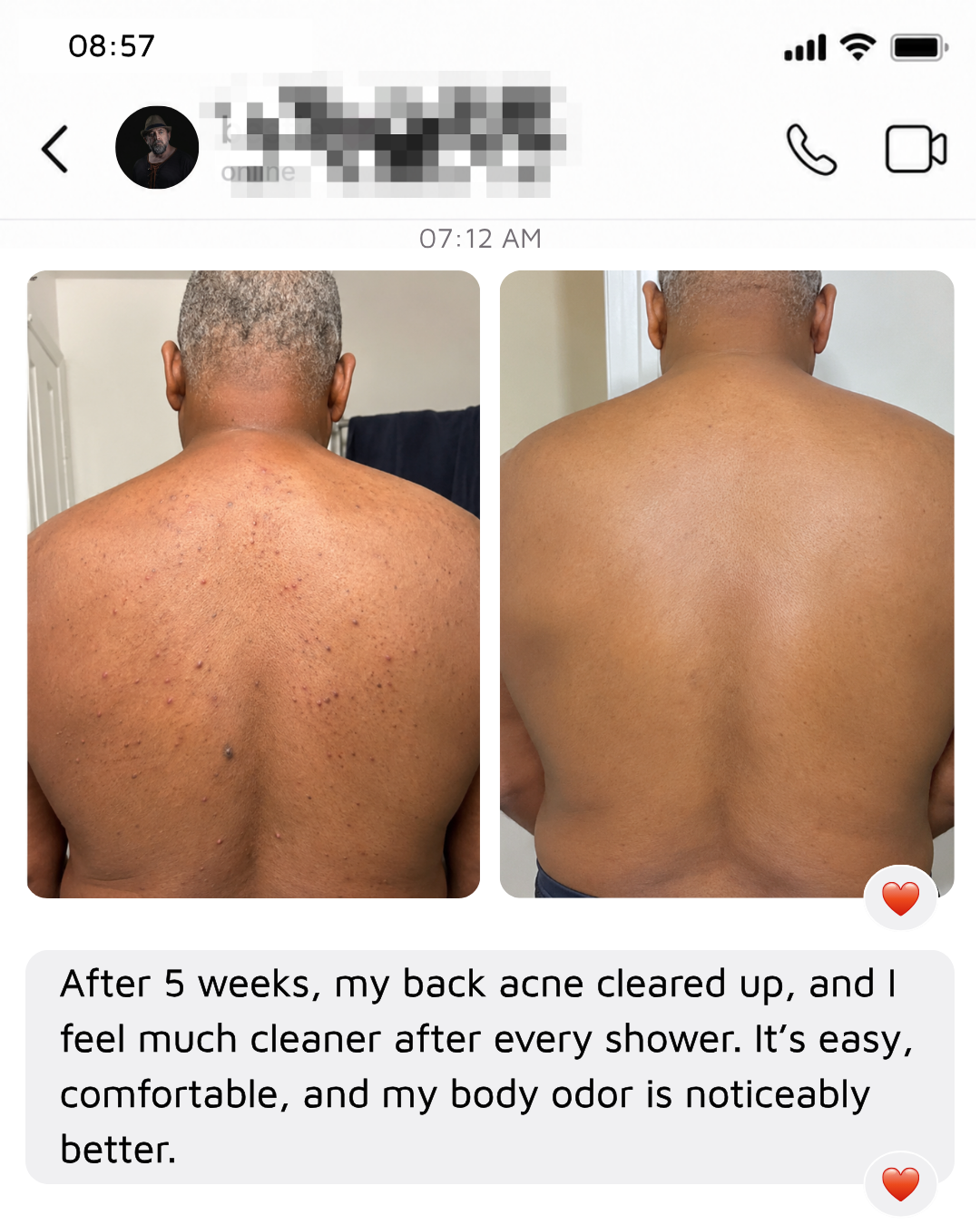 Quiettrial Electric Body Brush
