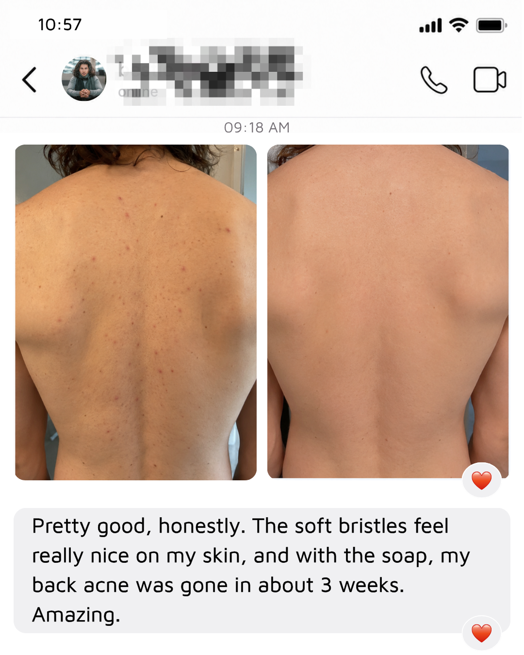 Quiettrial Electric Body Brush