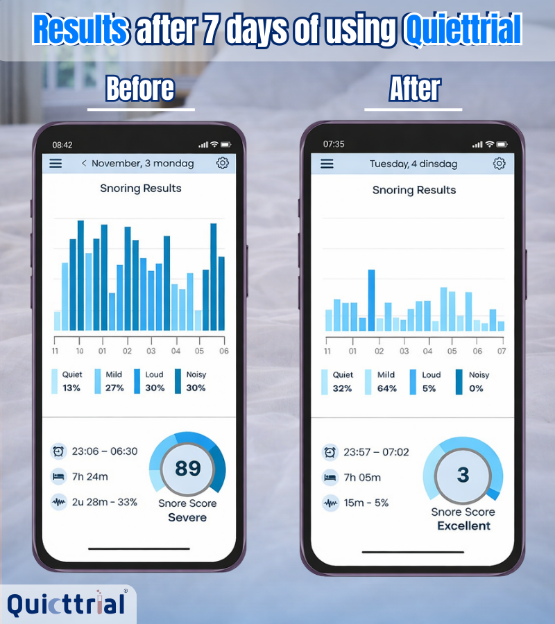 QuietTrial Plus+ Anti-Snoring Mouthpiece