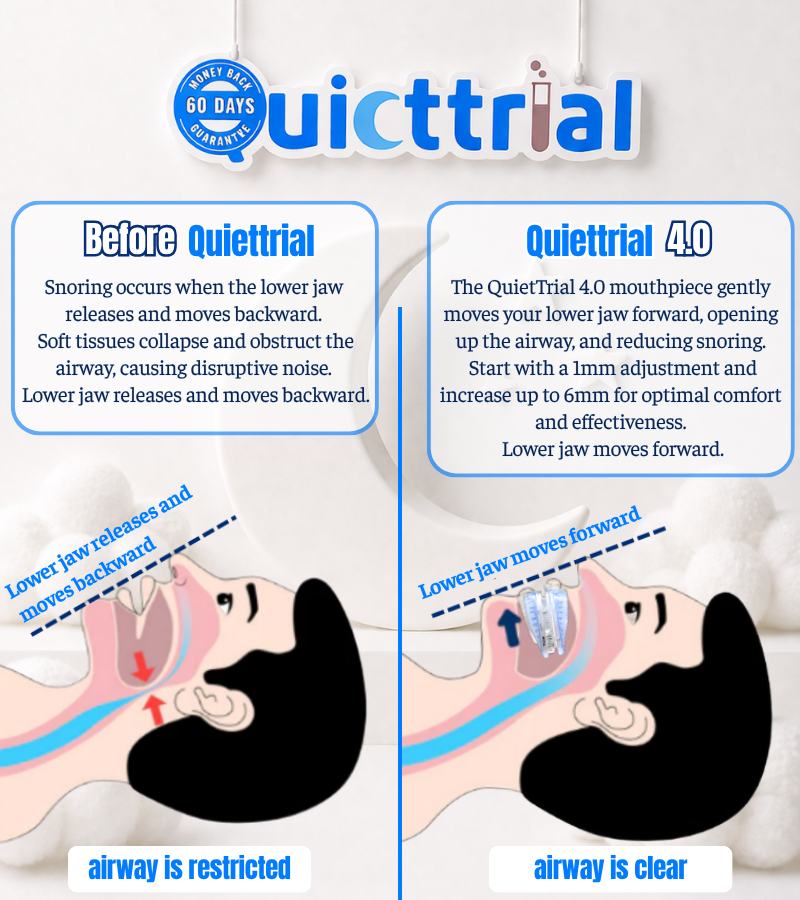 QuietTrial Plus® Anti-Snoring Mouthpiece