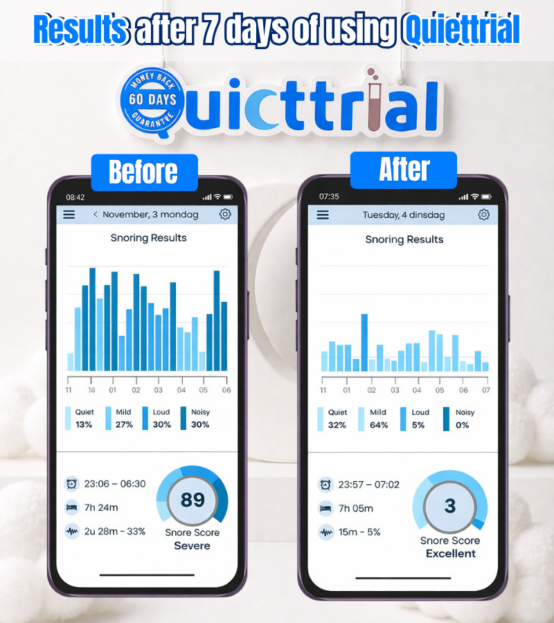 Quiettrial Pro® Anti-Snoring Mouthpiece